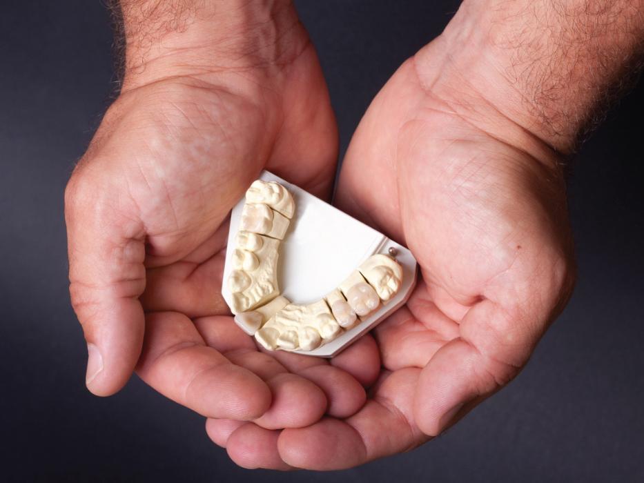 dental bridge | dental crown| palos heights IL